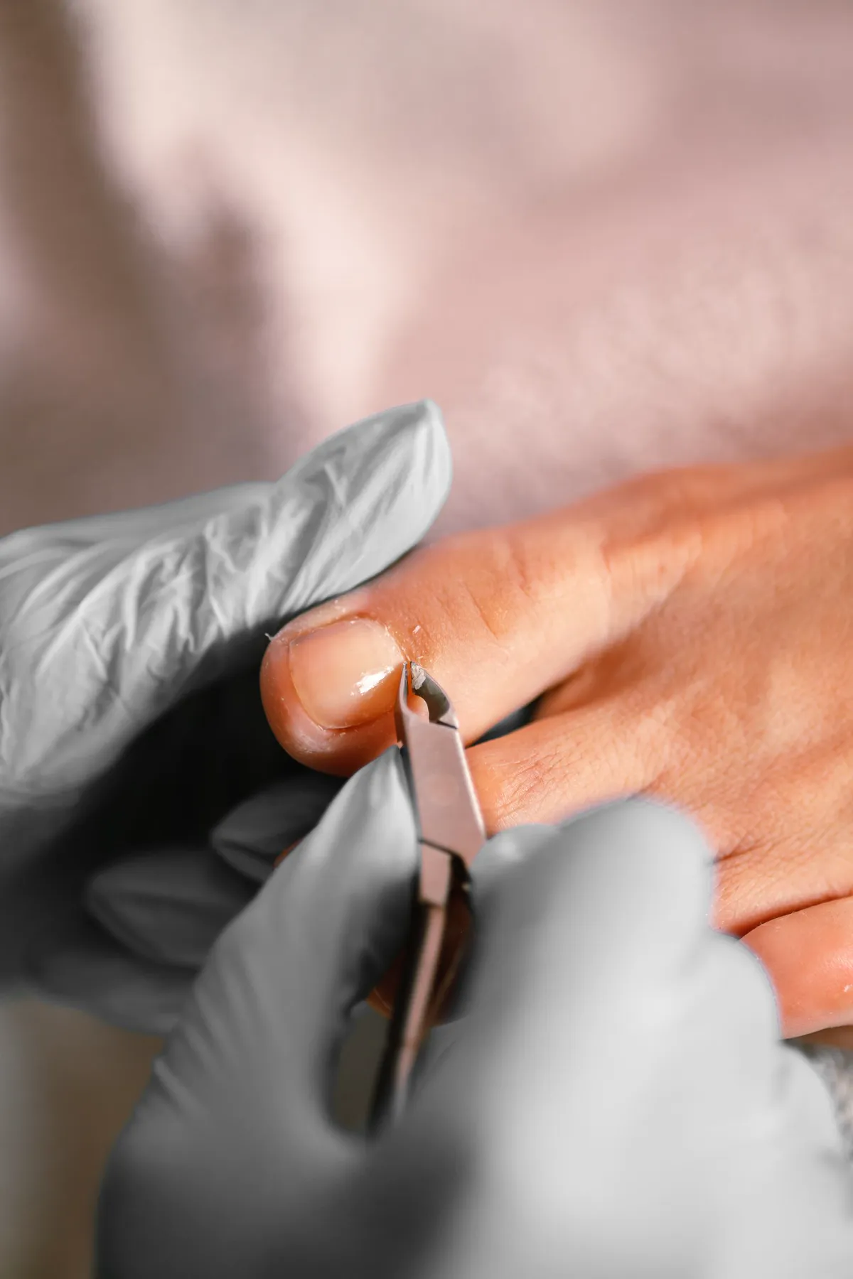 Uñas dolorosas o encarnadas